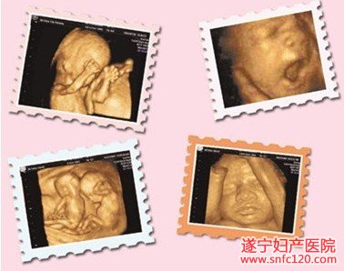 遂宁做四维彩超多少钱