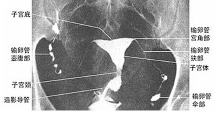 遂宁妇产医院最好的妇科医院