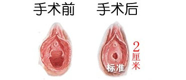 请问处女膜是什么样子的有没有什么网址有真人实图的资料可供查看呢?_微博生活网