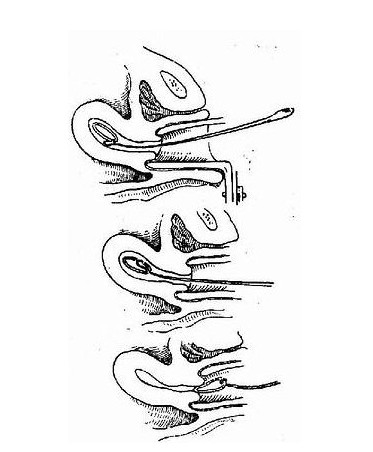 遂宁取环最好的医院