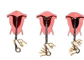 遂宁上环最好的医院