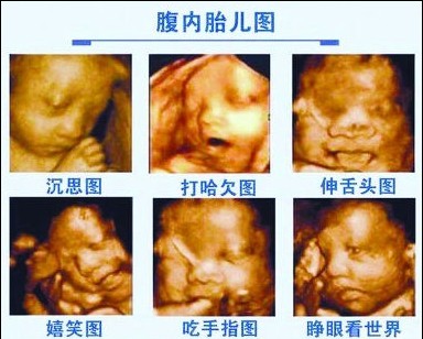 遂宁四维彩超的医院